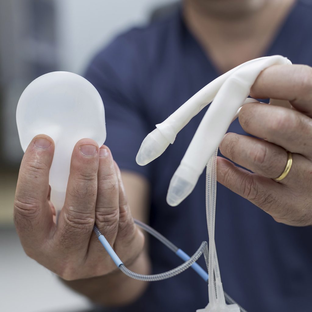 Dr. Paulo Egydio segurando uma prótese peniana inflável.